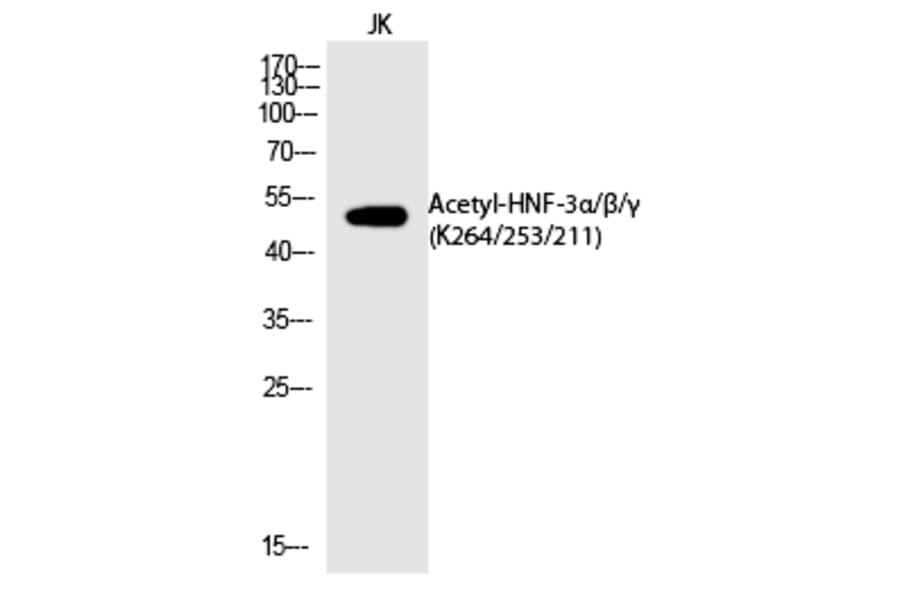 Western blot - HNF-3α/β/γ (Acetyl-Lys264/253/211) Polyclonal Antibody from Signalway Antibody (HW115)