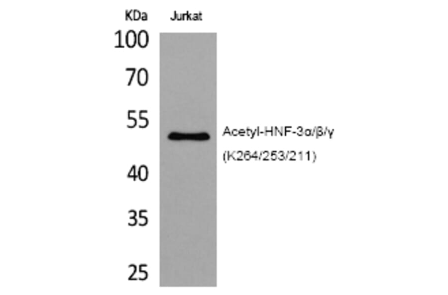 Western blot - HNF-3α/β/γ (Acetyl-Lys264/253/211) Polyclonal Antibody from Signalway Antibody (HW115)