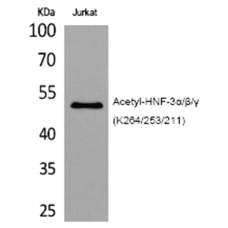 Western blot - HNF-3α/β/γ (Acetyl-Lys264/253/211) Polyclonal Antibody from Signalway Antibody (HW115)
