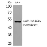 Western blot - HNF-3α/β/γ (Acetyl-Lys264/253/211) Polyclonal Antibody from Signalway Antibody (HW115)