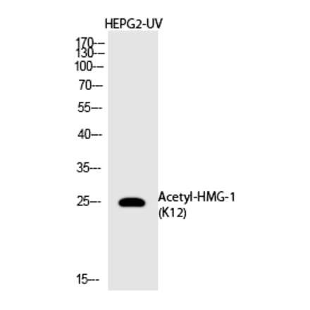 Western blot - HMG-1 (Acetyl-Lys12) Polyclonal Antibody from Signalway Antibody (HW144) - Antibodies.com
