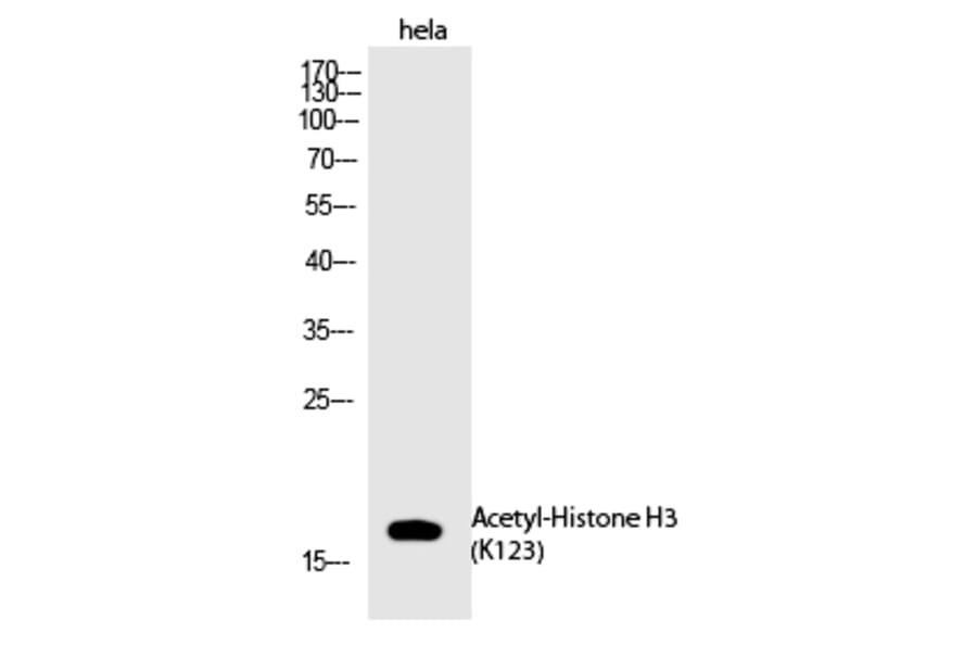 Western blot - Histone H3 (Acetyl-Lys123) Polyclonal Antibody from Signalway Antibody (HW143) - Antibodies.com