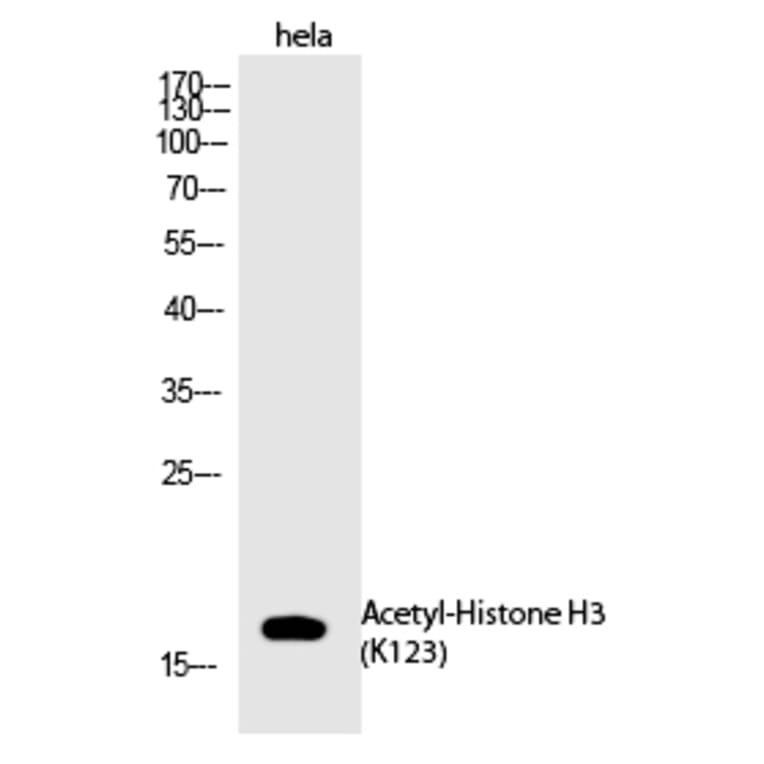 Western blot - Histone H3 (Acetyl-Lys123) Polyclonal Antibody from Signalway Antibody (HW143) - Antibodies.com