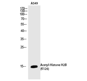 Western blot - Histone H2B (Acetyl-Lys126) Polyclonal Antibody from Signalway Antibody (HW116) - Antibodies.com