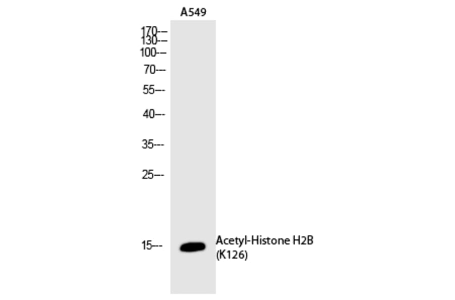 Western blot - Histone H2B (Acetyl-Lys126) Polyclonal Antibody from Signalway Antibody (HW116) - Antibodies.com