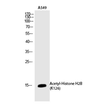 Western blot - Histone H2B (Acetyl-Lys126) Polyclonal Antibody from Signalway Antibody (HW116) - Antibodies.com