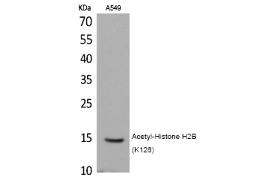 Western blot - Histone H2B (Acetyl-Lys126) Polyclonal Antibody from Signalway Antibody (HW116) - Antibodies.com