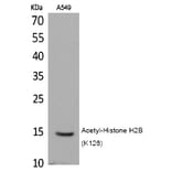 Western blot - Histone H2B (Acetyl-Lys126) Polyclonal Antibody from Signalway Antibody (HW116) - Antibodies.com