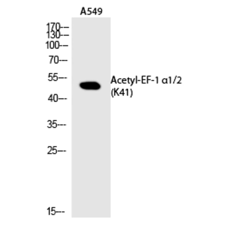 Western blot - EF-1 α1/2 (Acetyl-Lys41) Polyclonal Antibody from Signalway Antibody (HW117) - Antibodies.com