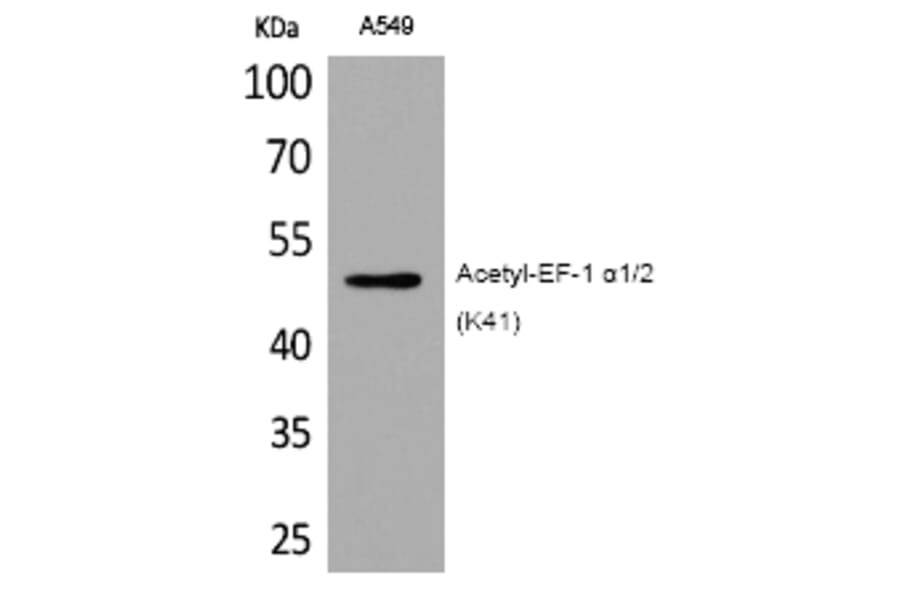 Western blot - EF-1 α1/2 (Acetyl-Lys41) Polyclonal Antibody from Signalway Antibody (HW117) - Antibodies.com