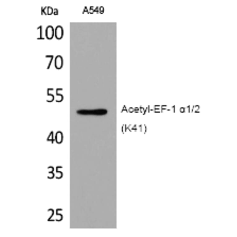 Western blot - EF-1 α1/2 (Acetyl-Lys41) Polyclonal Antibody from Signalway Antibody (HW117) - Antibodies.com
