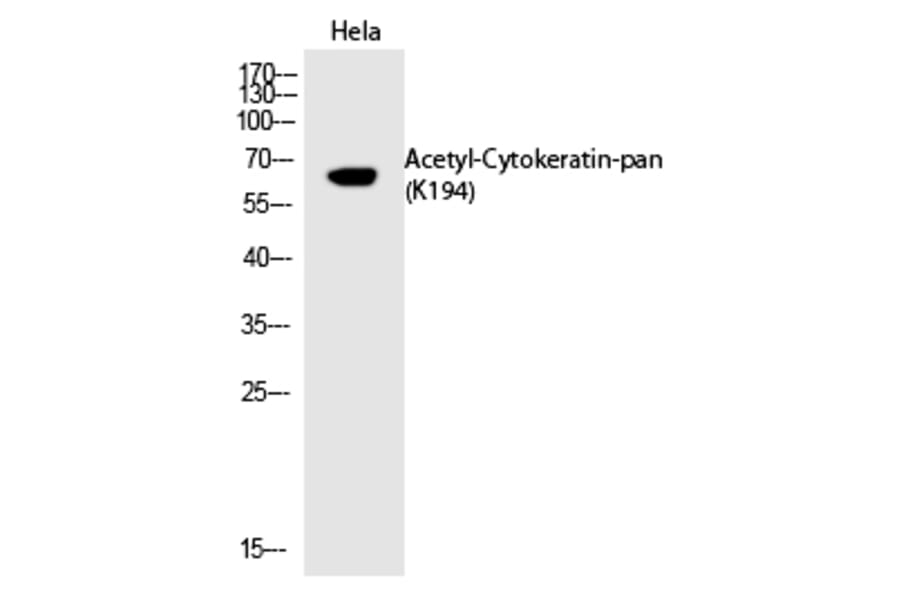 Western blot - Cytokeratin-pan (Acetyl-Lys194) Polyclonal Antibody from Signalway Antibody (HW128) - Antibodies.com