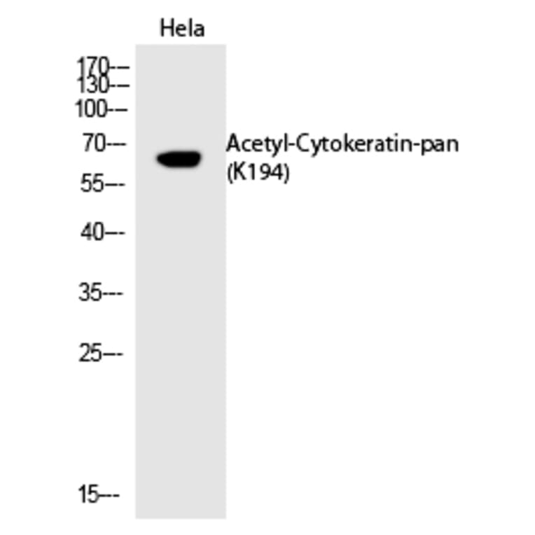 Western blot - Cytokeratin-pan (Acetyl-Lys194) Polyclonal Antibody from Signalway Antibody (HW128) - Antibodies.com