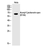 Western blot - Cytokeratin-pan (Acetyl-Lys194) Polyclonal Antibody from Signalway Antibody (HW128) - Antibodies.com
