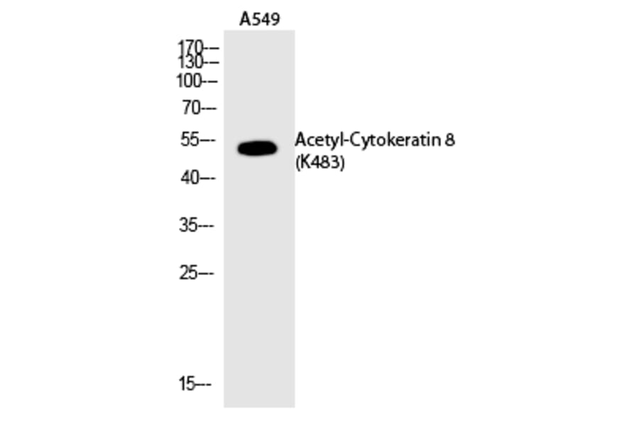 Western blot - Cytokeratin 8 (Acetyl-Lys483) Polyclonal Antibody from Signalway Antibody (HW120) - Antibodies.com