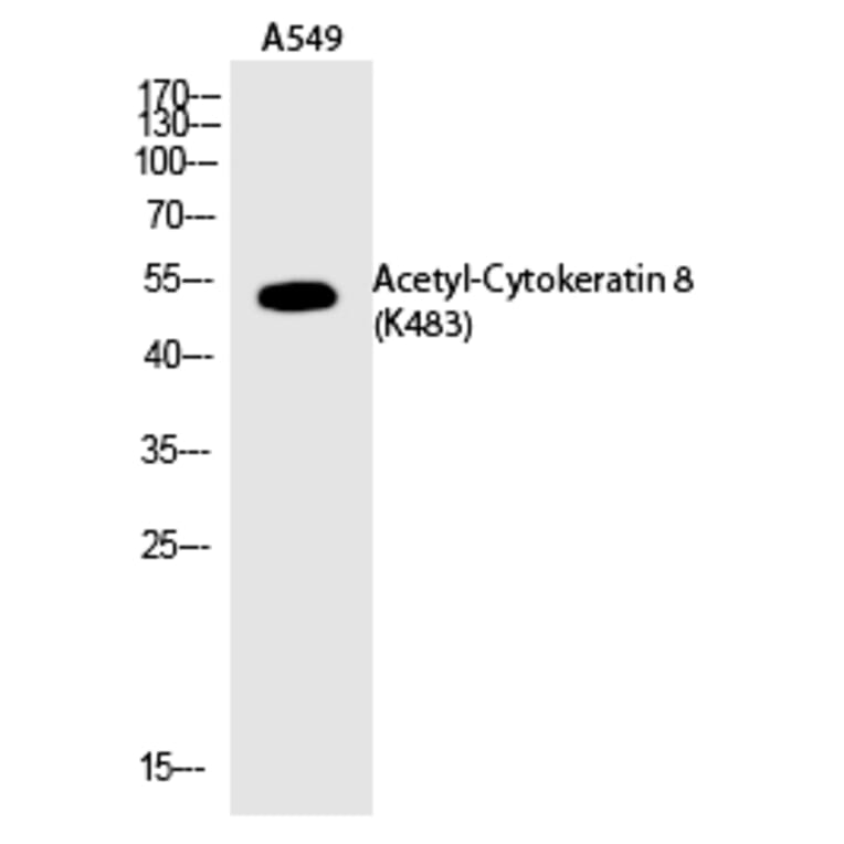 Western blot - Cytokeratin 8 (Acetyl-Lys483) Polyclonal Antibody from Signalway Antibody (HW120) - Antibodies.com