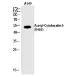 Western blot - Cytokeratin 8 (Acetyl-Lys483) Polyclonal Antibody from Signalway Antibody (HW120) - Antibodies.com