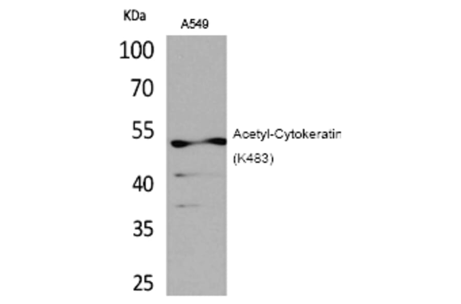 Western blot - Cytokeratin 8 (Acetyl-Lys483) Polyclonal Antibody from Signalway Antibody (HW120) - Antibodies.com