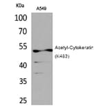 Western blot - Cytokeratin 8 (Acetyl-Lys483) Polyclonal Antibody from Signalway Antibody (HW120) - Antibodies.com