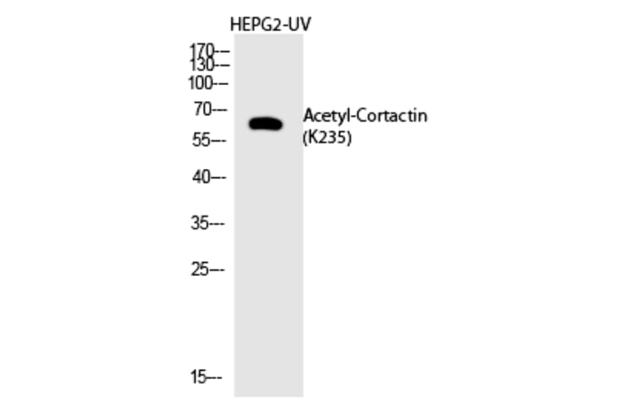 Western blot - Cortactin (Acetyl-Lys235) Polyclonal Antibody from Signalway Antibody (HW142) - Antibodies.com