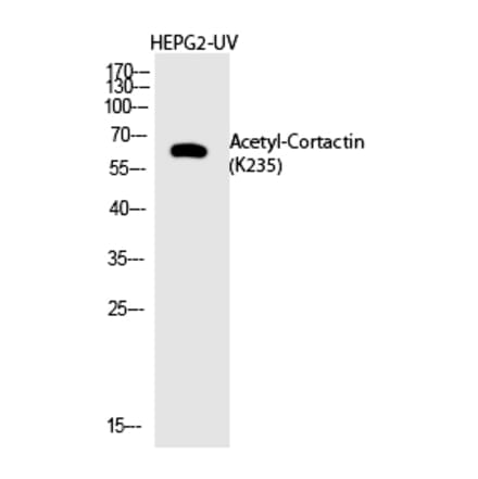 Western blot - Cortactin (Acetyl-Lys235) Polyclonal Antibody from Signalway Antibody (HW142) - Antibodies.com