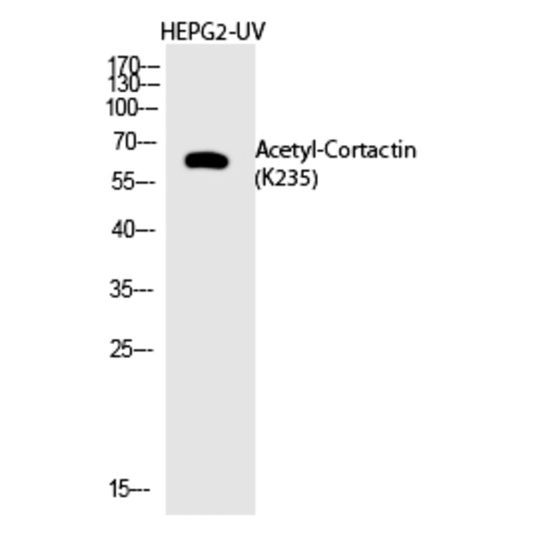 Western blot - Cortactin (Acetyl-Lys235) Polyclonal Antibody from Signalway Antibody (HW142) - Antibodies.com