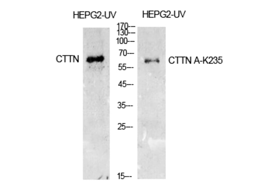 Western blot - Cortactin (Acetyl-Lys235) Polyclonal Antibody from Signalway Antibody (HW142) - Antibodies.com