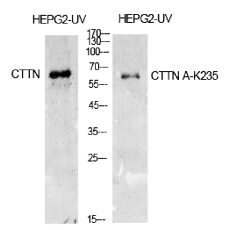 Western blot - Cortactin (Acetyl-Lys235) Polyclonal Antibody from Signalway Antibody (HW142) - Antibodies.com
