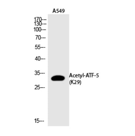 Western blot - ATF-5 (Acetyl-Lys29) Polyclonal Antibody from Signalway Antibody (HW114) - Antibodies.com