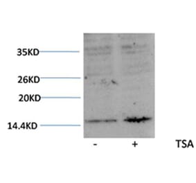 Western blot - Histone H3 (Acetyl-Lys27) Rabbit Polyclonal Antibody from Signalway Antibody (HW077) - Antibodies.com