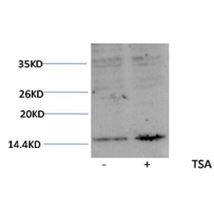 Western blot - Histone H3 (Acetyl-Lys27) Rabbit Polyclonal Antibody from Signalway Antibody (HW077) - Antibodies.com