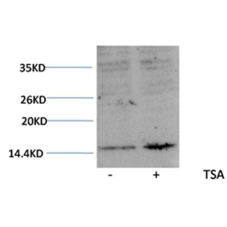 Western blot - Histone H3 (Acetyl-Lys27) Rabbit Polyclonal Antibody from Signalway Antibody (HW077) - Antibodies.com
