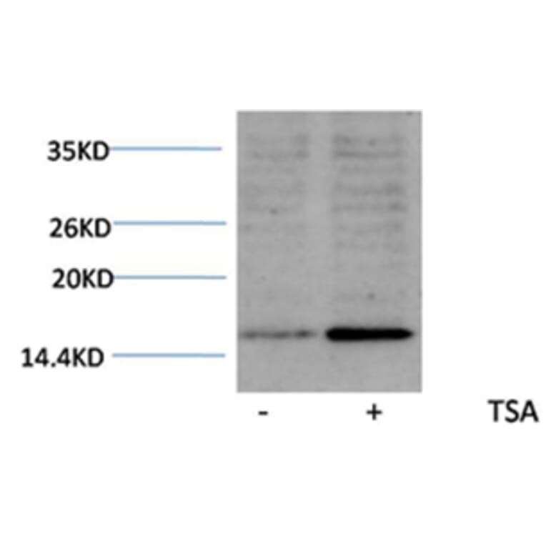 Western blot - Histone H3 (Acetyl-Lys18) Rabbit Polyclonal Antibody from Signalway Antibody (HW075) - Antibodies.com