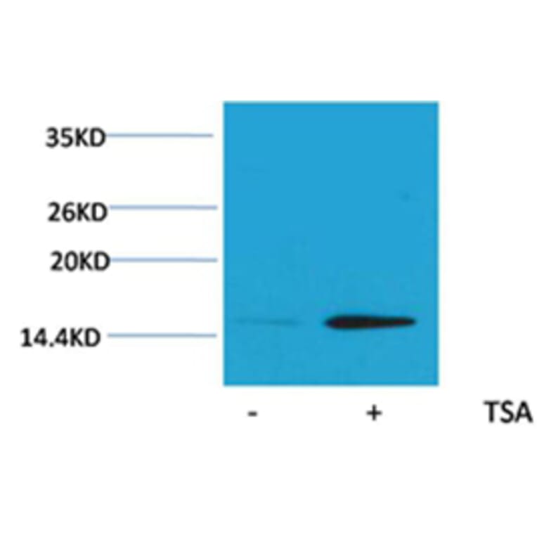 Western blot - Histone H2B (Acetyl-Lys20) Rabbit Polyclonal Antibody from Signalway Antibody - Antibodies.com