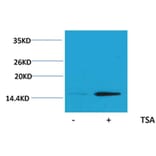 Western blot - Histone H2B (Acetyl-Lys20) Rabbit Polyclonal Antibody from Signalway Antibody - Antibodies.com