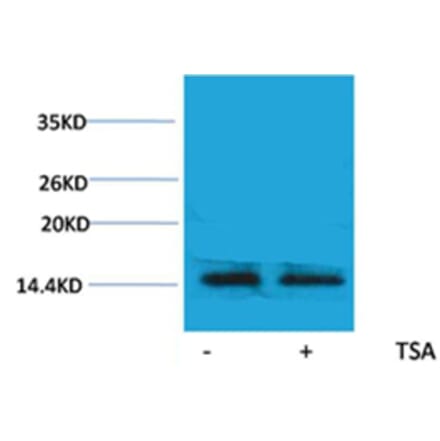 Western blot - Histone H2A.X (Acetyl-Lys5) Rabbit Polyclonal Antibody from Signalway Antibody - Antibodies.com