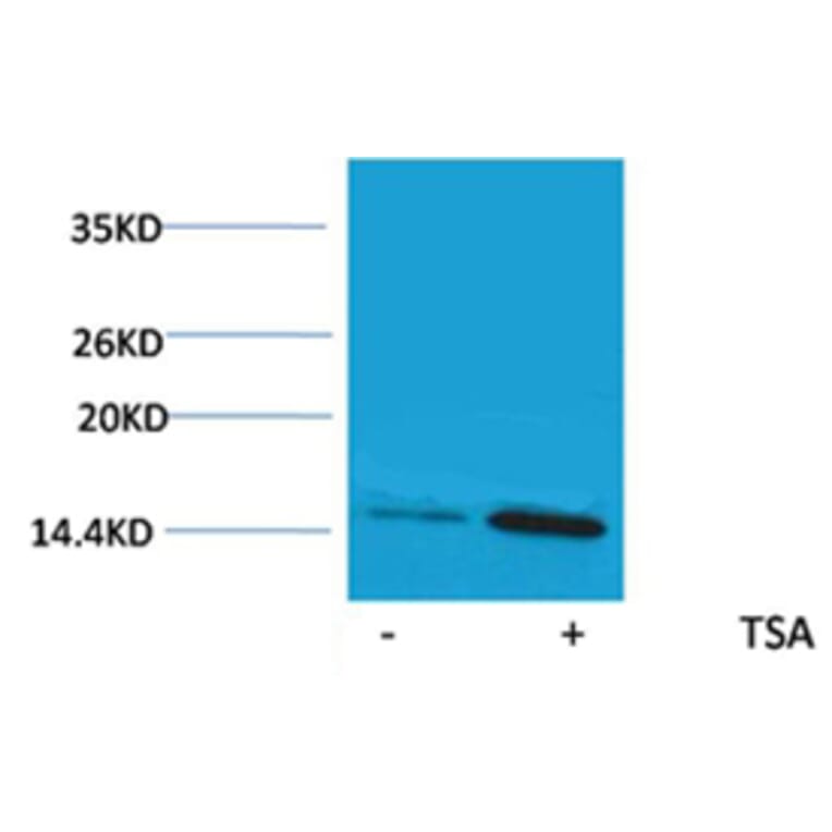 Western blot - Histone H2A (Acetyl-Lys9) Rabbit Polyclonal Antibody from Signalway Antibody (HW083) - Antibodies.com