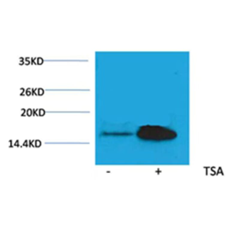 Western blot - Histone H2A (Acetyl-Lys5) Rabbit Polyclonal Antibody from Signalway Antibody (HW082) - Antibodies.com