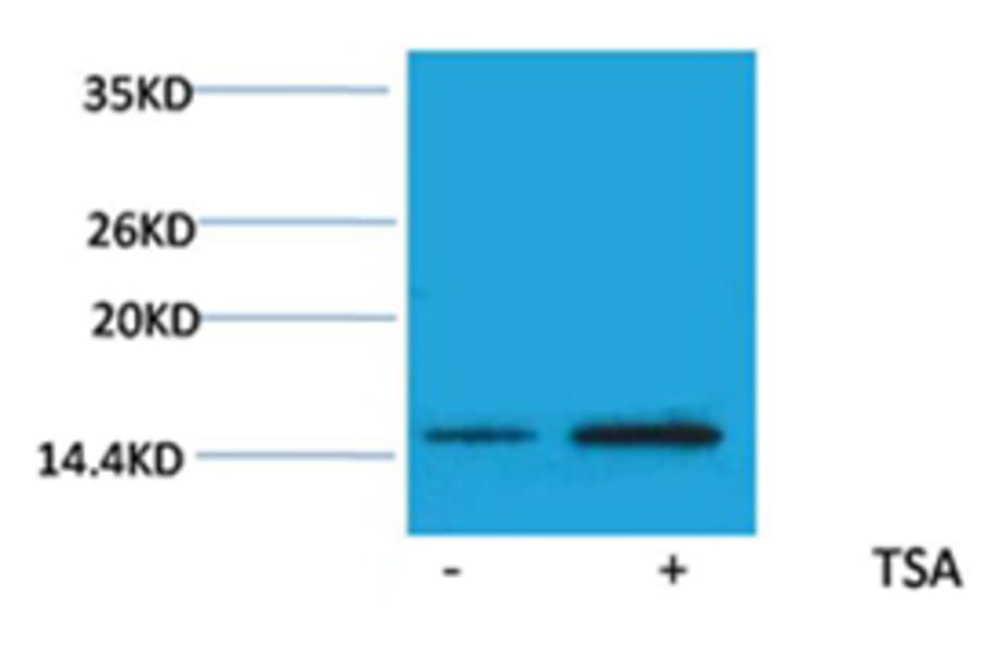 Western blot - Histone H2A (Acetyl-Lys15) Rabbit Polyclonal Antibody from Signalway Antibody - Antibodies.com