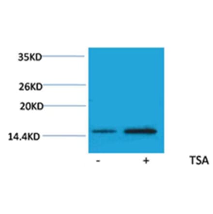Western blot - Histone H2A (Acetyl-Lys15) Rabbit Polyclonal Antibody from Signalway Antibody - Antibodies.com