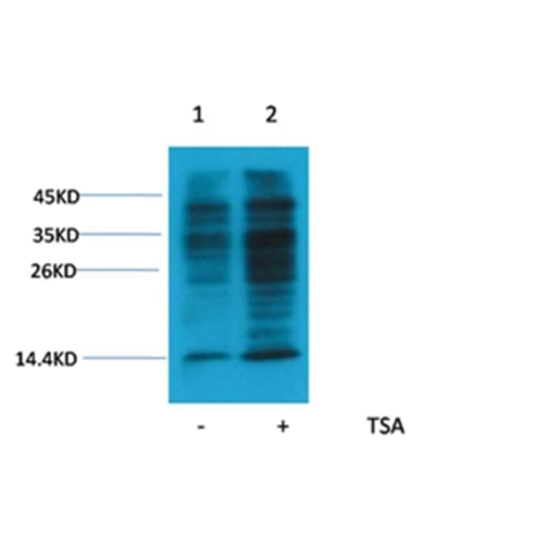 Western blot - Acetyl-Lysine Rabbit Polyclonal Antibody from Signalway Antibody (HW092) - Antibodies.com