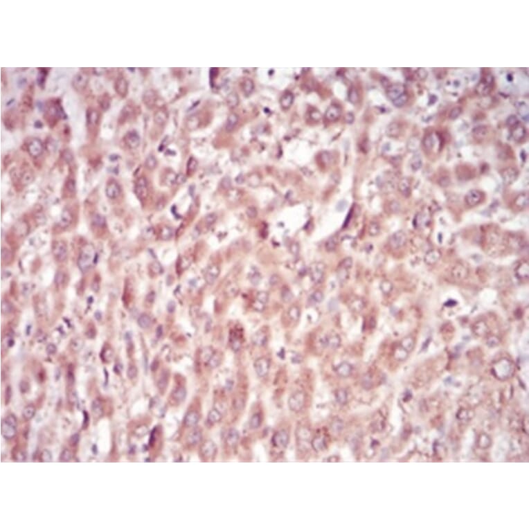 Immunohistochemistry - Anti-SAM Antibody from Arthus Biosystems (MA00202) - Antibodies.com