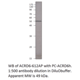 Anti-Atypical Chemokine Receptor D6 Antibody (FITC) from FabGennix (ACRD6H-FITC) - Antibodies.com