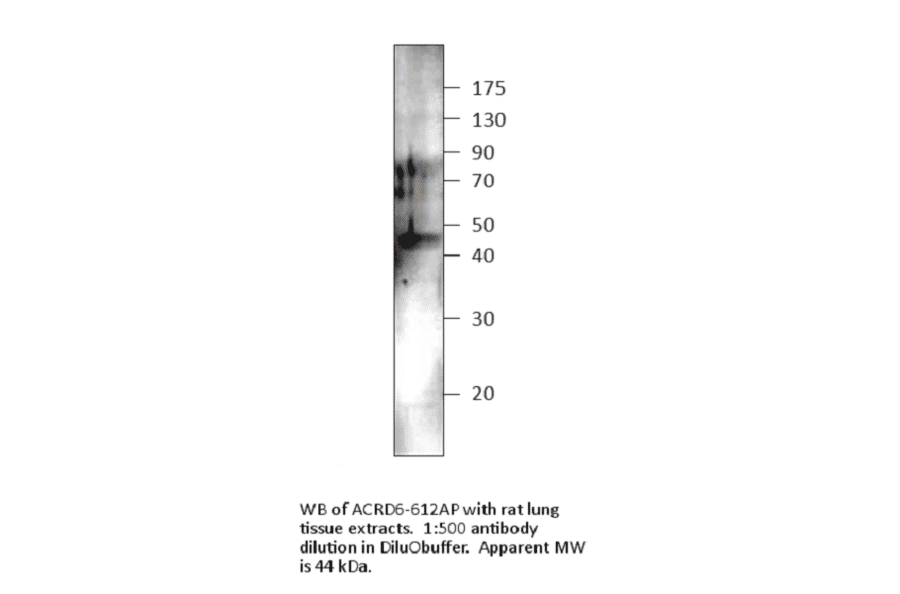 Anti-Atypical Chemokine Receptor D6 Antibody (FITC) from FabGennix (ACRD6H-FITC) - Antibodies.com