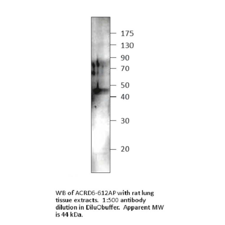 Anti-Atypical Chemokine Receptor D6 Antibody (FITC) from FabGennix (ACRD6H-FITC) - Antibodies.com