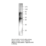 Anti-Atypical Chemokine Receptor D6 Antibody (FITC) from FabGennix (ACRD6H-FITC) - Antibodies.com