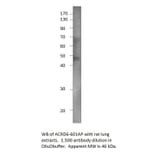 Anti-Atypical Chemokine Receptor D6 Antibody (FITC) from FabGennix (ACRD6M-FITC) - Antibodies.com