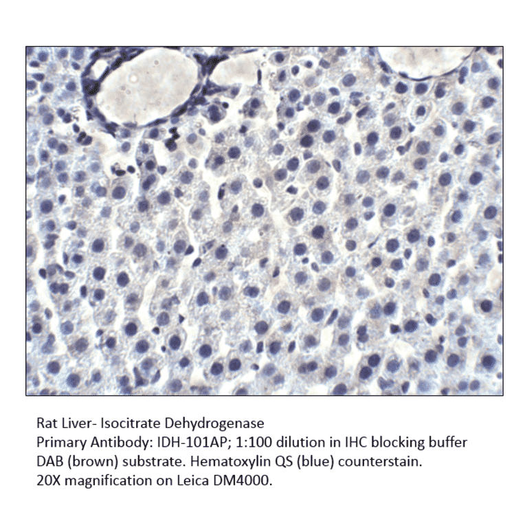 Anti-Isocitrate dehydrogenase Antibody from FabGennix (IDH-101AP) - Antibodies.com