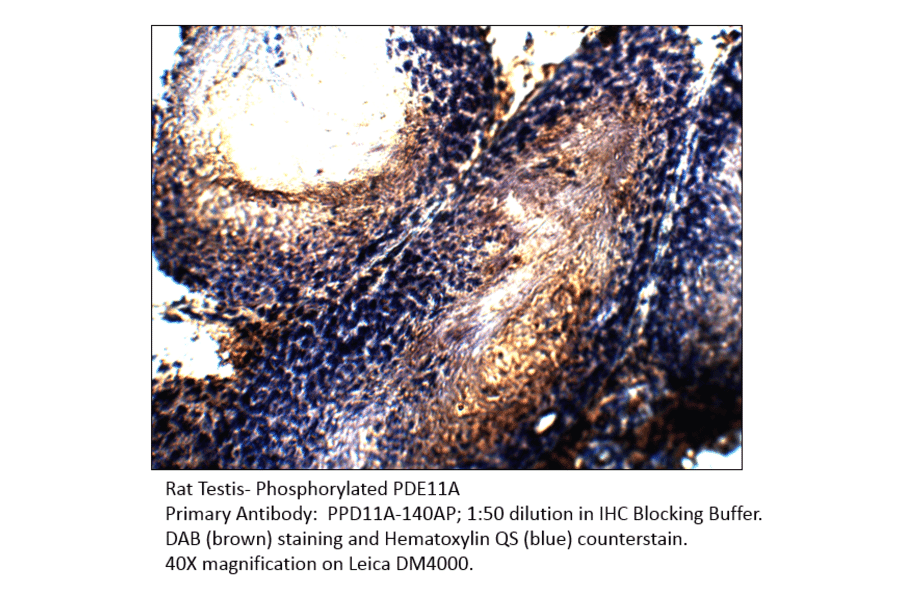 Anti-Phospho-PDE11A Antibody (S117) from FabGennix (PPD11A-140AP) - Antibodies.com