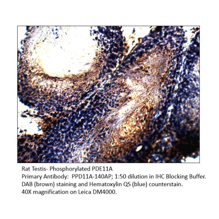 Anti-Phospho-PDE11A Antibody (S117) from FabGennix (PPD11A-140AP) - Antibodies.com